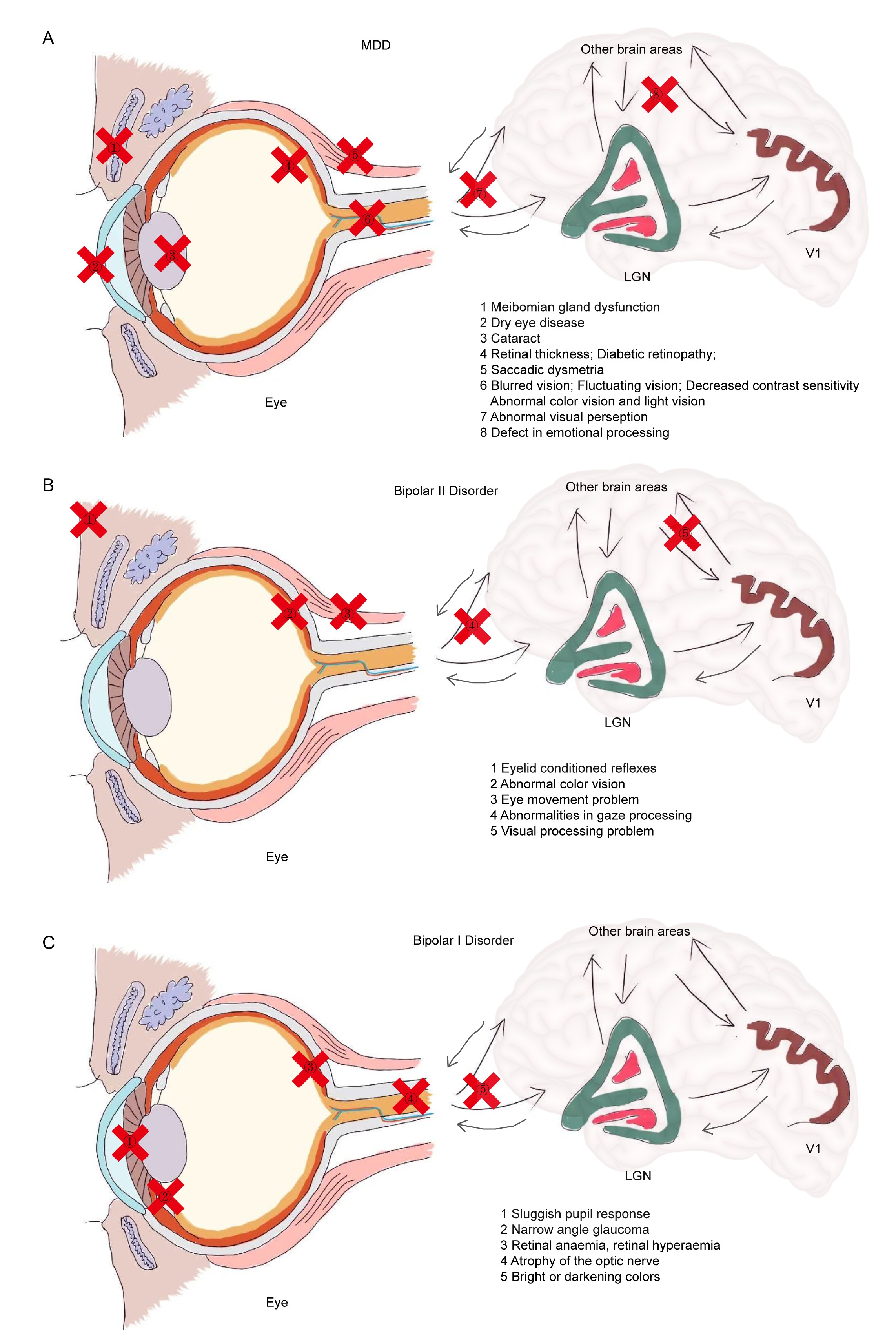 Eye-brain axis research